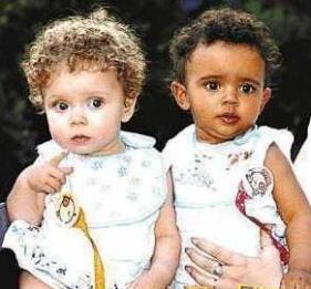 世界上最奇怪的双胞胎，令人难以置信!