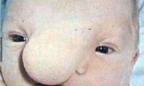世界上最丑的宝宝，青蛙婴儿没有脖子眼睛巨凸其丑无比