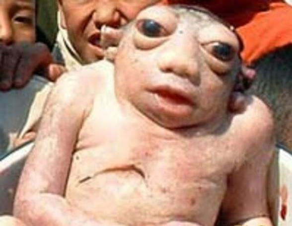 世界上最丑的宝宝，青蛙婴儿没有脖子眼睛巨凸其丑无比