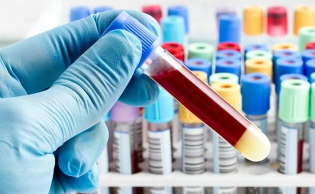验血新法有望为侦测癌症带来重大突破。