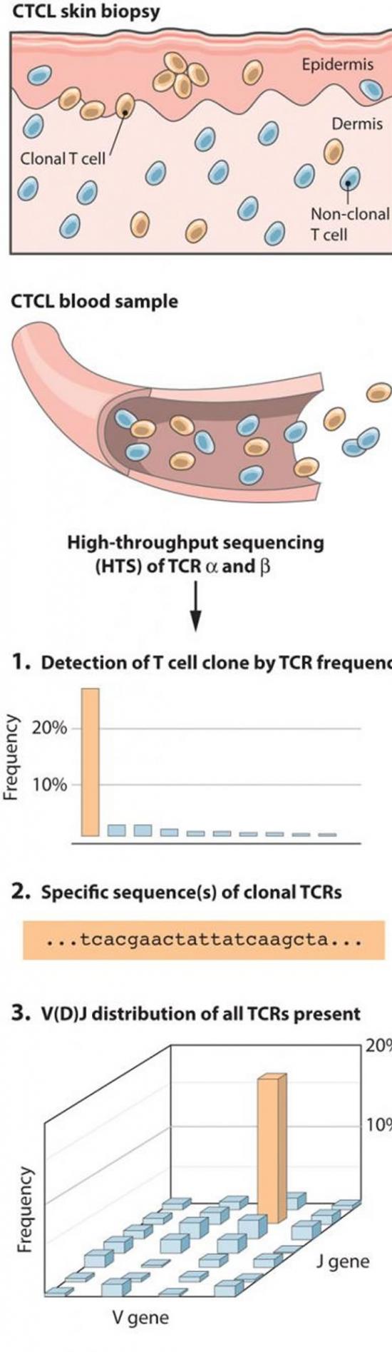 对重新排列的T细胞受体（TCR）基因进行高通量测序为皮肤T细胞淋巴瘤中的T细胞群提供了前所未有的信息。在获取皮肤活检或外周血样本之后，被提取的基因组DNA被PC