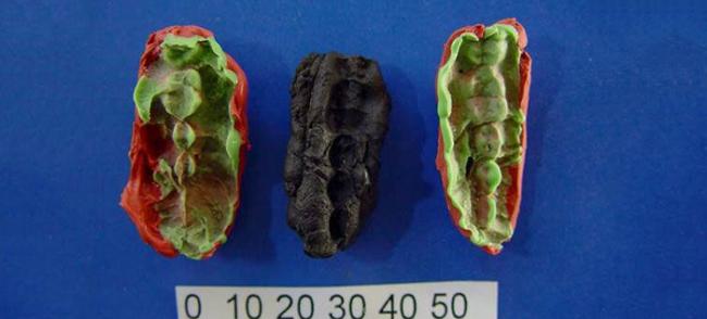 瑞典8000年前古老“口香糖”包含人类DNA