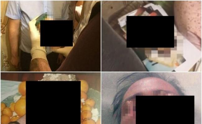警方发现疑似人头（左上），以及用瓶子装着的残肢（左下）。现场有疑犯玩弄头颅照（右上），网上并有疑为疑犯口咬残肢的照片（右下）。
