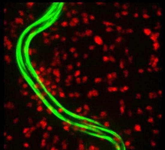 图中嗜曙红细胞是红色部分，秀丽隐杆线虫幼虫是绿色部分，这张照片非常形象真实地显示老鼠体内白血球细胞如何攻击寄生虫。在大约54分钟时，秀丽隐杆线虫开始从一大群嗜曙