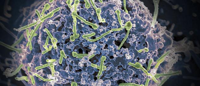 人体内发现新蛋白 或能帮助医生找到治疗埃博拉病毒的新方法