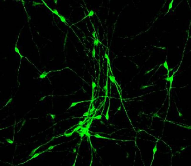 小分子处理后的人脑胶质细胞已转化为神经细胞，由 宾夕法尼亚州立大学陈功教授实验室提供。