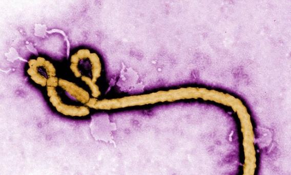 伊波拉病毒去年在西非多国爆发