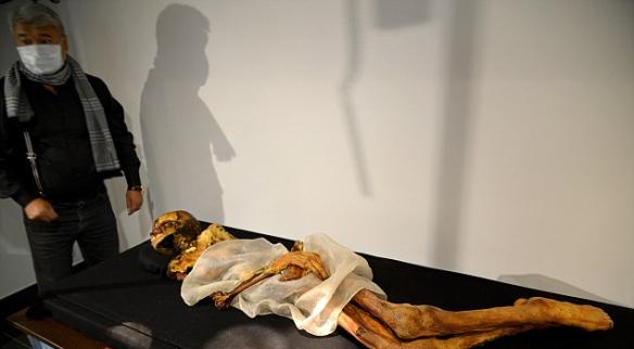 埃及4200年历史成年女性骨骸发现最古老的乳腺癌证据