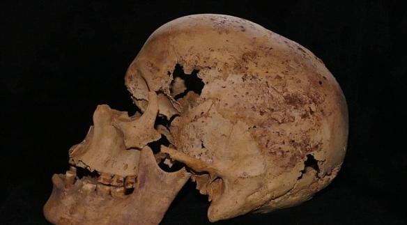 埃及4200年历史成年女性骨骸发现最古老的乳腺癌证据