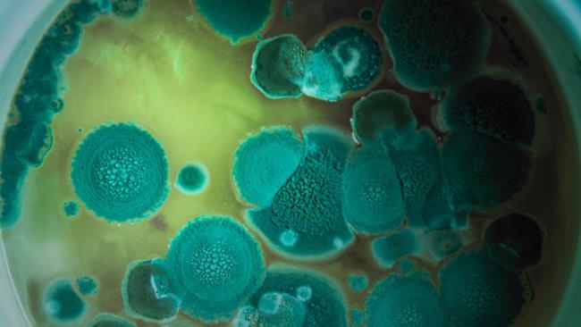 免疫细胞可通过触发真菌孢子自杀而中止真菌感染