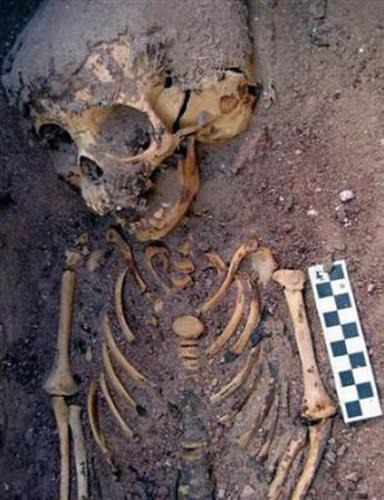 女童的上身骨骼，该考古研究证实古埃及存在着虐待儿童的现象