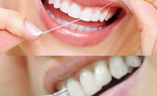牙缝刷及牙线有不同功用。