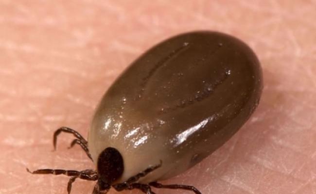 英科学家发现新疾病“Borrelia Miyamotoi” 由蜱虫传播致头痛乏力