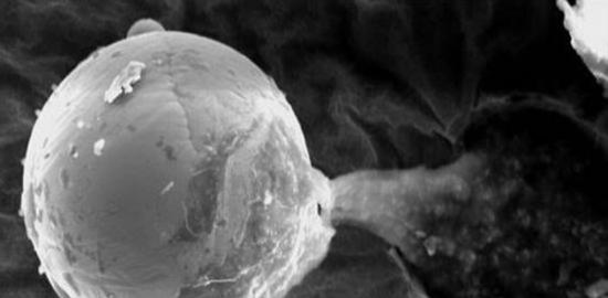 韦恩莱特和他的研究小组发现的微型金属球，向外流出粘性物质。他指出这个金属球的直径与一根头发相当，可能是一个定向胚种。韦恩莱特的言论显然是在支持一种观点，即生命是
