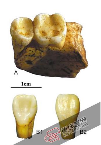 巫山人牙齿化石