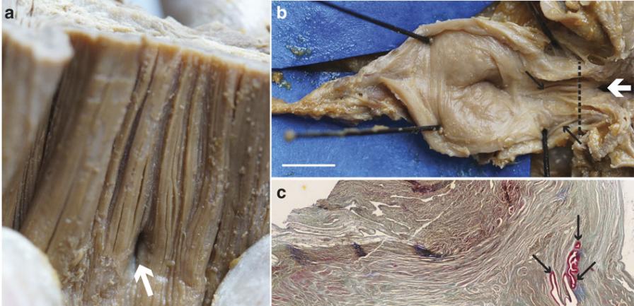 新研究确认活着的腔棘鱼有肺的存在，但不再具有任何实际功能