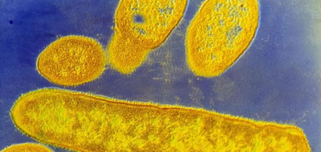 脆弱拟杆菌是一种肠道寄居菌