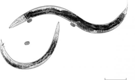 身长仅一毫米的线虫，特别偏爱癌细胞的味道，图为显微镜下的线虫。