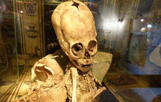 秘鲁出现神秘大头小身骨骸，人类学家表示可能是外星人