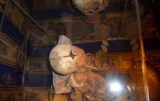 秘鲁出现神秘大头小身骨骸，人类学家表示可能是外星人