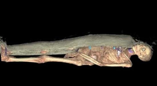 CT扫描后的木乃伊图像, 这具木乃伊制作时间大约在3000年前