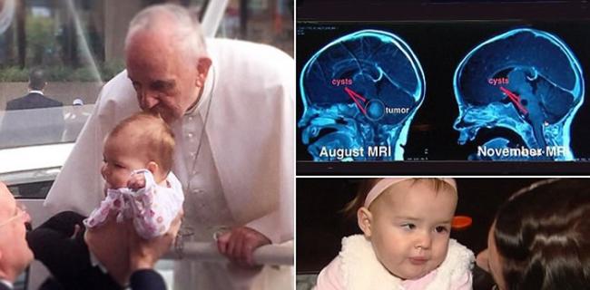 美国孩子在被罗马教皇亲吻后癌症病愈