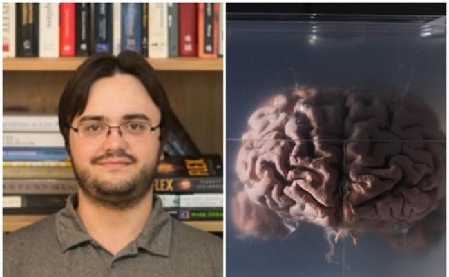 麦金太尔（左图）称以新技术成功冷冻人脑。