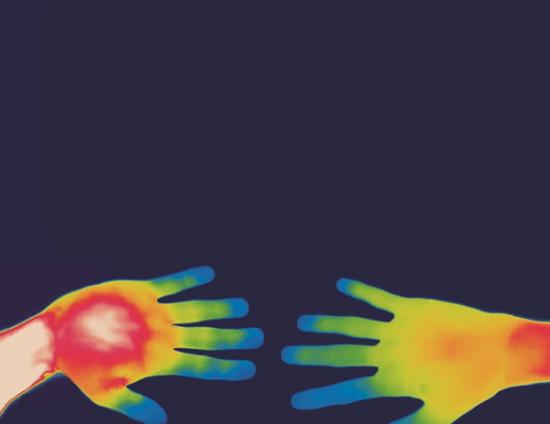 男性与女性手部温度的差异，透过热能照片显露无遗