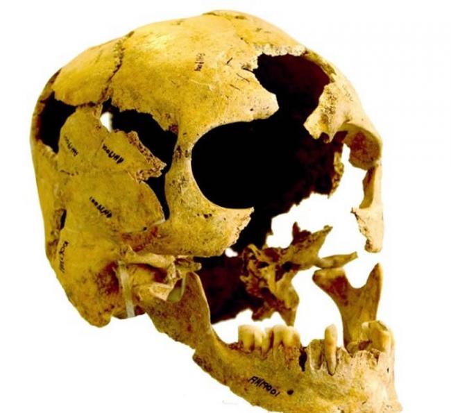 伊朗出土的10000年前新石器时代古人类头骨(photo/©: Courtesy Fereidoun Biglari, National Museum