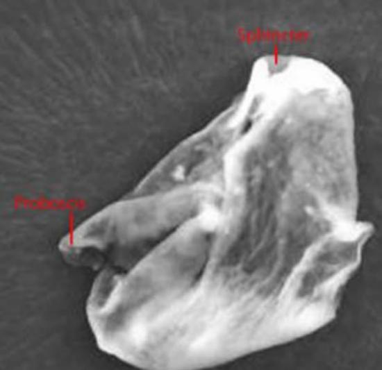 长有鼻子――或者动物头部的“外来有机体”，它有两个类似鼻孔的开口和一个“括约肌”。