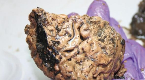 考古学家在英国约克郡发现2600年前铁器时代的人类大脑
