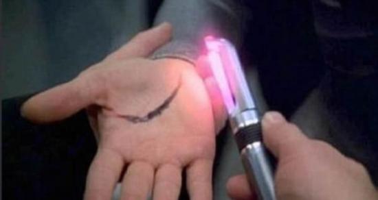 在《星际迷航》中也有类似的情景，飞船的船员使用一种手持式设备可以使伤口快速愈合