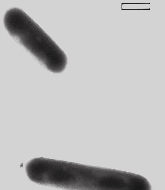 电子显微镜下的以氨为食的古生菌。
