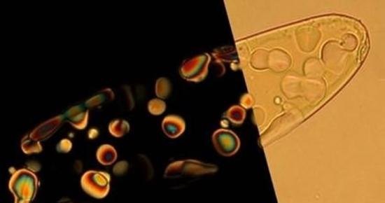 图片显示的一滴浓缩的纳米-DNA，其中含有偏振光下才能看到的液晶滴(左侧)。这些液晶滴扮演着“微反应器”的作用，短链DNA可以在没有生物学反应的情况下自组装形成