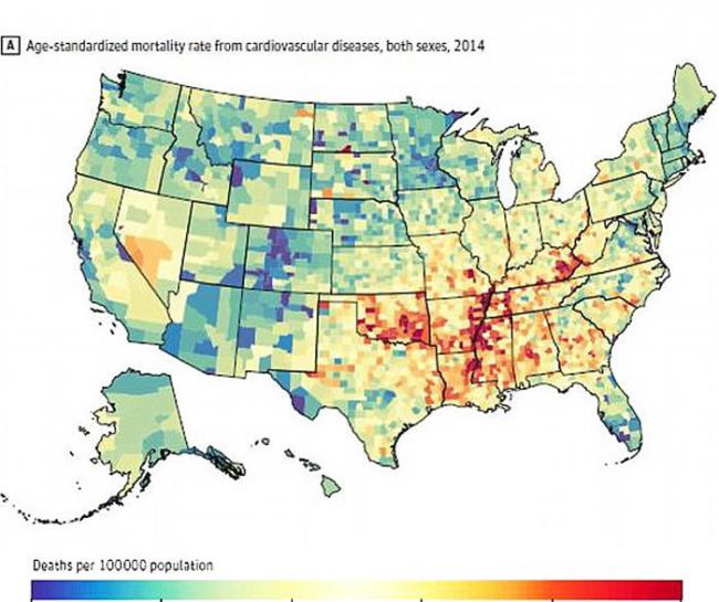 美国出生在中风死亡率高的州内的人与罹患痴呆症风险增加相关