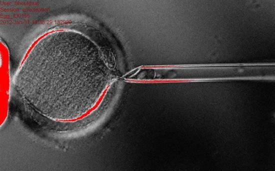 克隆人类胚胎干细胞