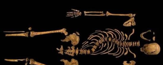 驼背国王：去年9月出土的这具骸骨显示出椎骨弯曲和在战争中受伤的迹象，这与人们认为的金雀花王朝最后一位国王理查三世的遭遇相同