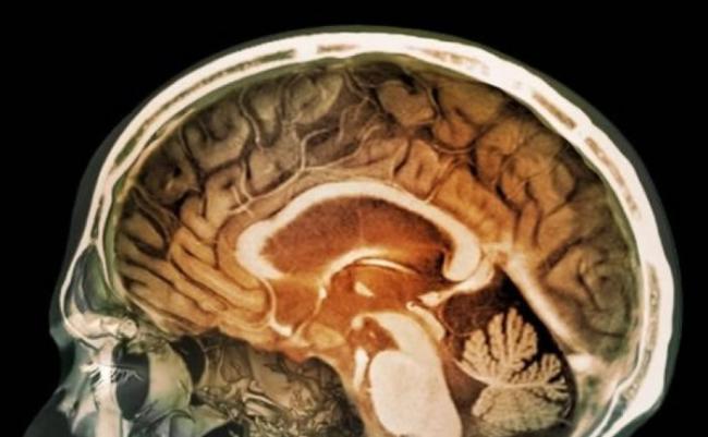 英国研究发现空气中磁性纳米微粒能进入人类脑部 或增患脑退化症风险