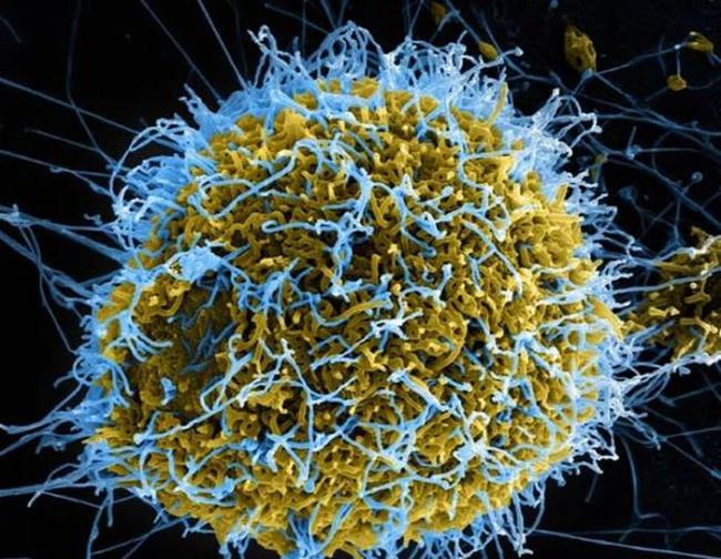 如图所示，这是丝状埃博拉病毒(蓝色部分)从一个慢性感染细胞(黄绿色部分)萌芽生长。最新一项研究表明，病毒与人体蛋白质的交互作用，促进人类的适应性进化发展。