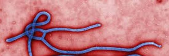 当局已排除病原是伊波拉病毒的可能性