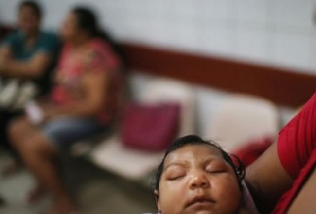 巴西研究人员于小头症婴儿的脑内发现寨卡病毒