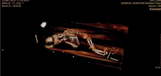 婴尸是研究员为棺木进行电脑断层扫描时发现