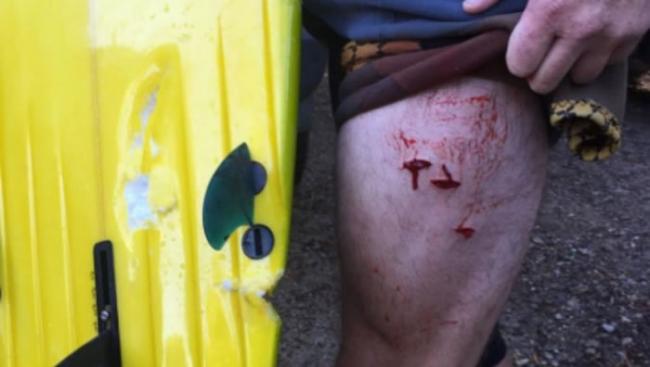 滑浪者腿部被咬，但伤势不太严重。