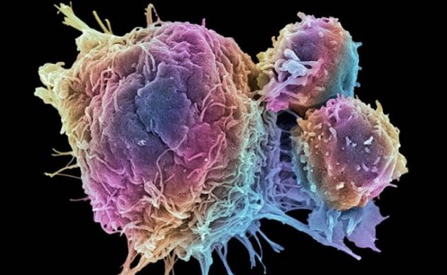新免疫疗法有效防止癌细胞死灰复燃。