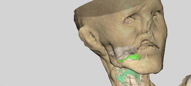 科学家重建5300多年前冰人奥茨木乃伊的声带和喉咙 重现他的声音