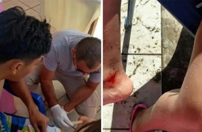 15名游客在墨西哥纳亚里特州度假区被海鳝袭击