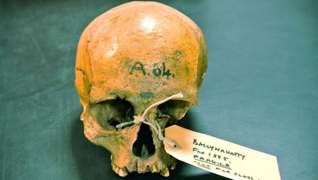 Ballynahatty头骨：1855年出土于贝尔法斯特附近，躺在新石器时代的陵墓室长达5000年，展览于贝尔法斯特女王大学。（图片来源：丹尼尔布拉德利，都柏林
