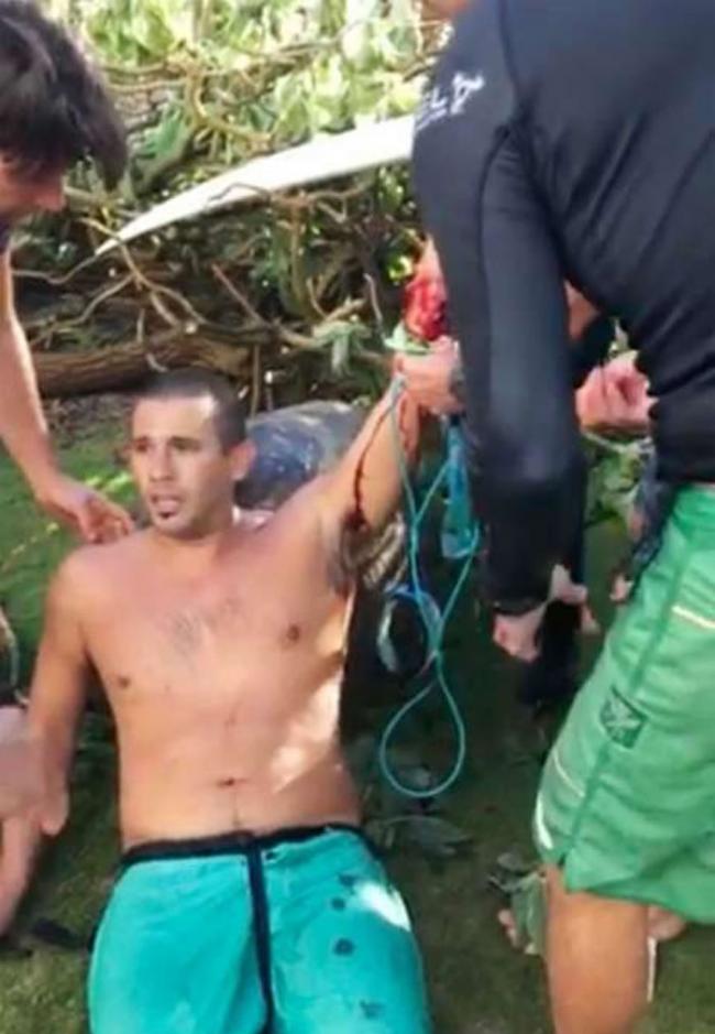 美国男子在夏威夷滑浪期间遭鲨鱼咬伤手脚