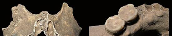 青龙泉新石器时代居民上颌骨颊面及下颌骨舌面的圆枕状骨质隆起。（周蜜供图）
