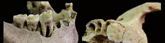 青龙泉新石器时代居民下颌臼齿磨耗角度，A 倾斜状的牙齿磨耗面；B 水平状的牙齿磨耗面。（周蜜供图）